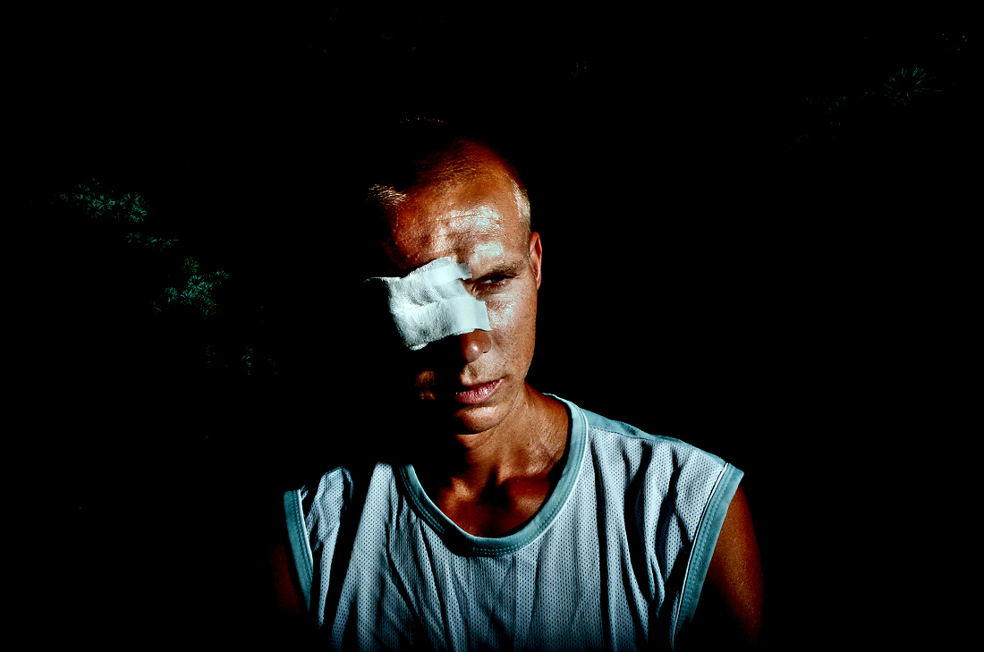 Miner with Eye Injury  - Ansett, Richard